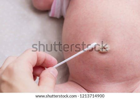 Treatment of newborn baby navel with a cotton swab Royalty-Free Stock Photo #1213714900