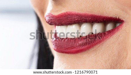 mid age lady after delivering her zircon teeth