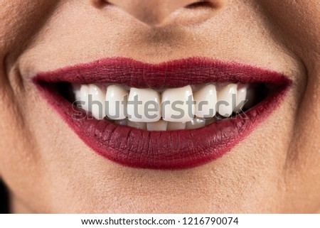 mid age lady after delivering her zircon teeth