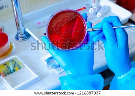 Petri dish. Microbiological laboratory. Mold and fungal cultures. Bacterial research Royalty-Free Stock Photo #1216887037