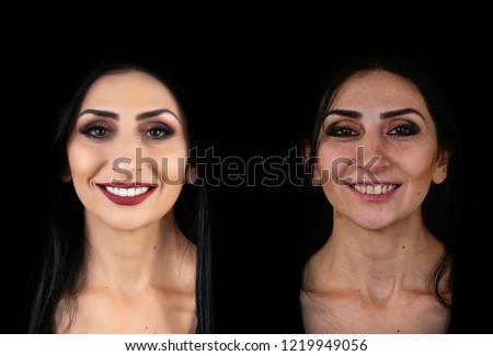 before and after picture for a young lady after having her ceramic veneers