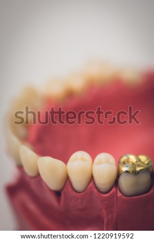 Detailed close up of dental denture or teeth on a table, dentistry