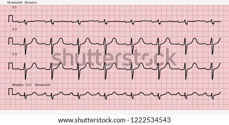 llustration of medical electrocardiogram - ECG on chart paper Royalty-Free Stock Photo #1222534543