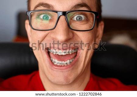 Man with brackets dental. Braces on his teeth with smile and glasses