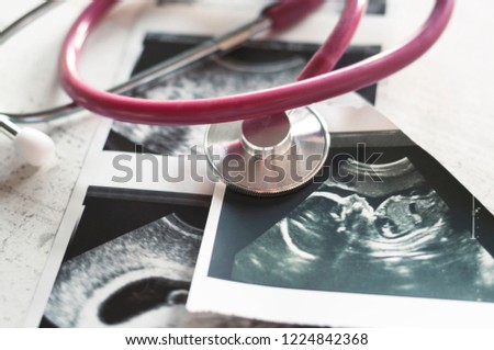 In the pictures of the ultrasound 4 weeks of pregnancy and 20 weeks is a phonendoscope. The concept of the study of pregnancy. Observation Selective focus