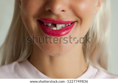 Adult woman with broken front tooth smiling Royalty-Free Stock Photo #1227749836