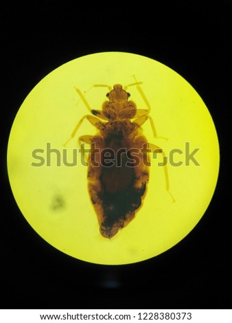 Bedbug in light microscope