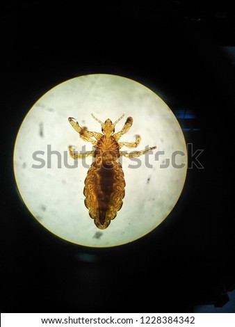 Pediculosis capitis(head louse) in light microscope