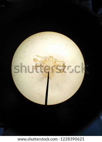 Crab louse (pubic lose) in light microscope