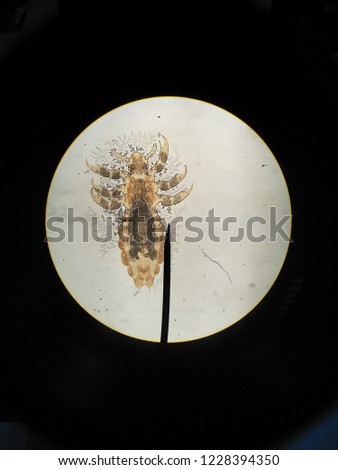 Pediculus humanus capitis (head louse) in light microscope