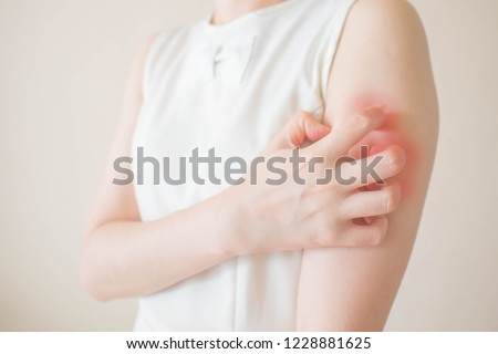 Young woman scratching arm from having itching on white background. Cause of itchy skin include insect bites, dermatitis, food/drugs allergies or dry skin. Health care concept. Close up. Royalty-Free Stock Photo #1228881625