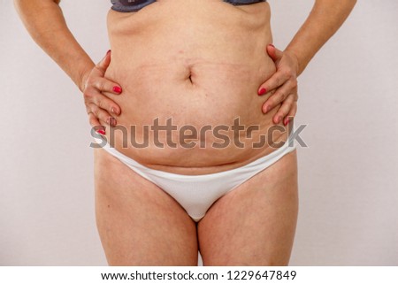 Elderly woman in white panties with cellulite and varicose veins on her legs and a big belly on a light isolated background. Concept for medicine and cosmetology.