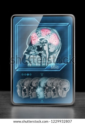 Modern tablet displaying brain activity scan