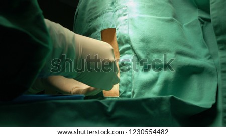 Spinal Anaesthesia procedure or Lumbar Puncture under aseptic technique.