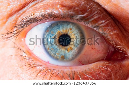 male blue eye macro