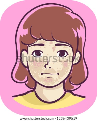 Illustration of a Kid Girl with Brown Patches on Her Face