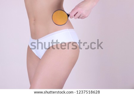 Close-up Of A Woman Checking Cellulite With Magnifying Glass.