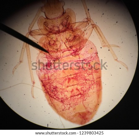 Triatoma Infestans ( Kissing Bug )