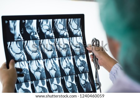 Seriously woman doctor holding and looking patient bone x-ray film before surgery.Image MRI and CT scan at radiology orthopedic unit in hospital.Knee join xray for treatment.Selective focus.
