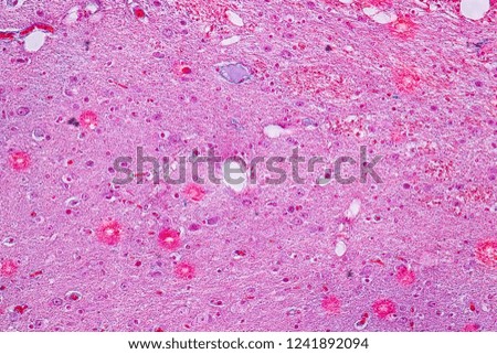Cross section of the Cerebellum and Nerve human under the microscope for education in Lab.
