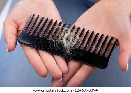 Close-up Of A Woman's Hand Holding Comb With Hair Loss