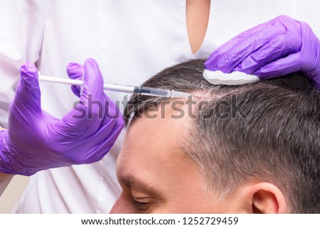 Injection, Treatment for Hair Loss Royalty-Free Stock Photo #1252729459
