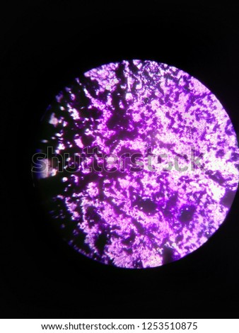 Gram staining - Staphylococcus aureus.
under an optical microscope, the magnification was 40*10.
