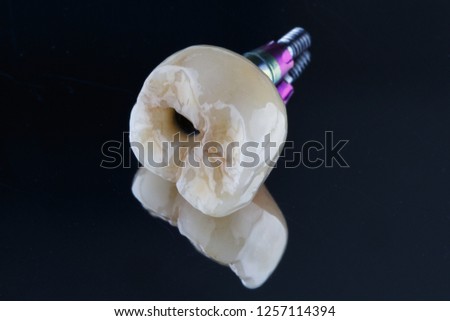ceramic crown on a tooth chewing in complete