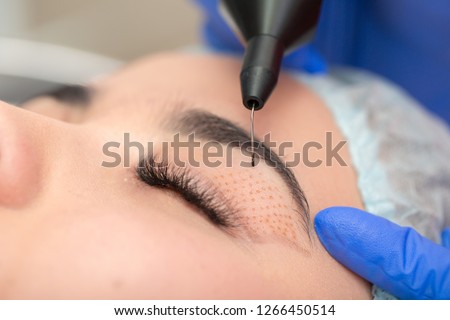 Cosmetic procedure to strengthen the skin of the eyelids. Non-surgical blepharoplasty on plasma IQ apparatus. Cosmetology for facial rejuvenation. Royalty-Free Stock Photo #1266450514