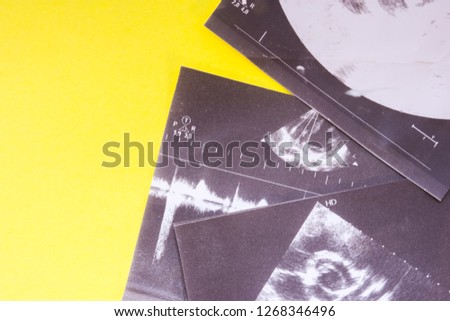 Result of ultasound examination on yellow uniform background view from above with the clear area of half photo for labels, headers. Concept photo for sonogram procedure, diagnosis by ultrasound 