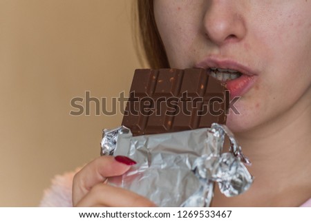 Young woman with acne problem eating chocolate bar and sweets . Skin allergy. Concept of skin problems 