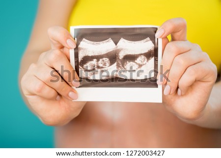 Close-up of unrecognizable pregnant woman holding ultrasound scan on her belly background. Maternity, motherhood, pregnancy, love, twins concept.