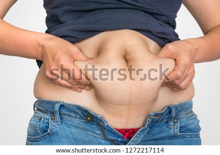 Overweight woman body with fat on belly - overweight and obesity concept