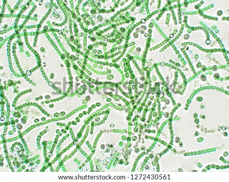 Nostoc sp. algae under microscopic view Royalty-Free Stock Photo #1272430561