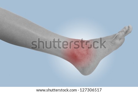 Acute pain in a woman ankle. Female holding hand to spot of ankle-ache. Concept photo with Color Enhanced blue skin with read spot indicating location of the pain.
