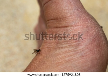Woman's dry skin on foot with Housefly, Close up & Macro shot, Selective focus, Asian body skin part, Healthcare concept