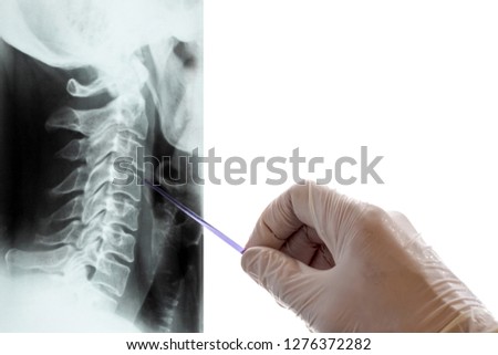 Closeup of the hand of a man in a white medical glove who holds a pointer and shows the spine on an X-ray. A picture of the cervical vertebrae. Day of the physician and radiologist. Copy space. White