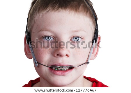 Boy with braces and headgear Royalty-Free Stock Photo #127776467