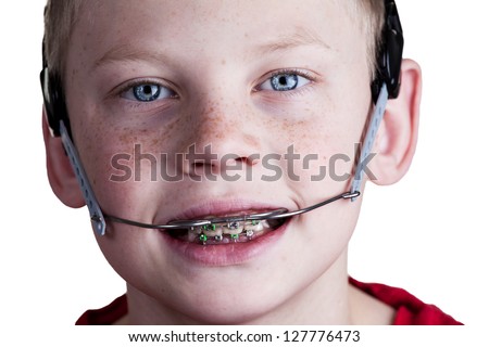 Boy with braces and headgear Royalty-Free Stock Photo #127776473