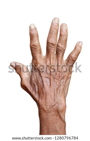 Hand back of Old man's hand or Senior woman's back of hands isolated on white background, Old women's wrinkled palms, Top view of wrinkled hand on white background, Handicapped hand