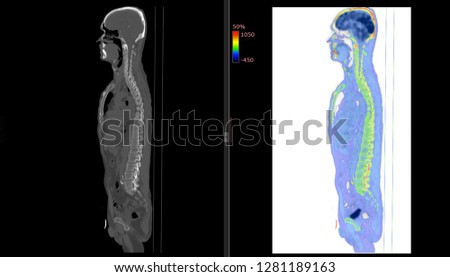 CT scan of Human Body/ Other Radiological Images (CT, MRI, PET CT, X-ray) in my portfolio