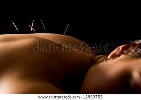 Woman getting an acupuncture treatment in a spa Royalty-Free Stock Photo #12833755