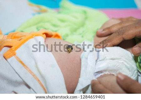 Newborn baby navel
