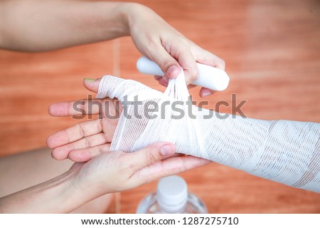 Burn from hot oil splashed on the arms and legs And wound by sterilizing and closing with a bandage. Royalty-Free Stock Photo #1287275710