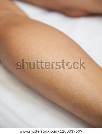 Goosebumps on leg after massage
