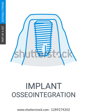 Dental implant Vector Icon.