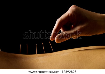 Woman getting an acupuncture treatment in a spa Royalty-Free Stock Photo #12892825