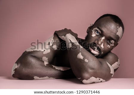 Close up fashion portrait of a male afro or african model with white pigmentation. Concept of no racism. Conceptual image of young man at pink studio background Royalty-Free Stock Photo #1290371446
