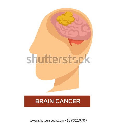 Brain cancer oncology disease and chemotherapy isolated vector malignant or benigne tumor in human head medicine and illness or sickness treatment or cure