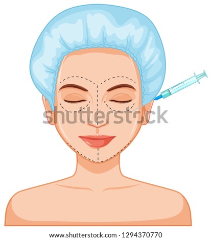 Facial botox filler skin injection illustration